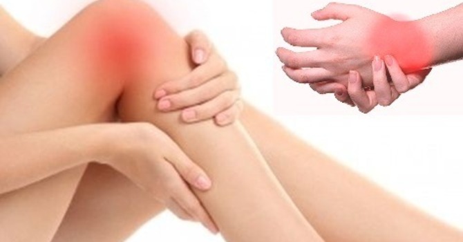 Arthritis – Natural Support for Joint Pain Part 2 image