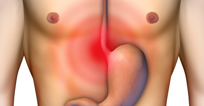 Digestion – Acid Reflux – GERD